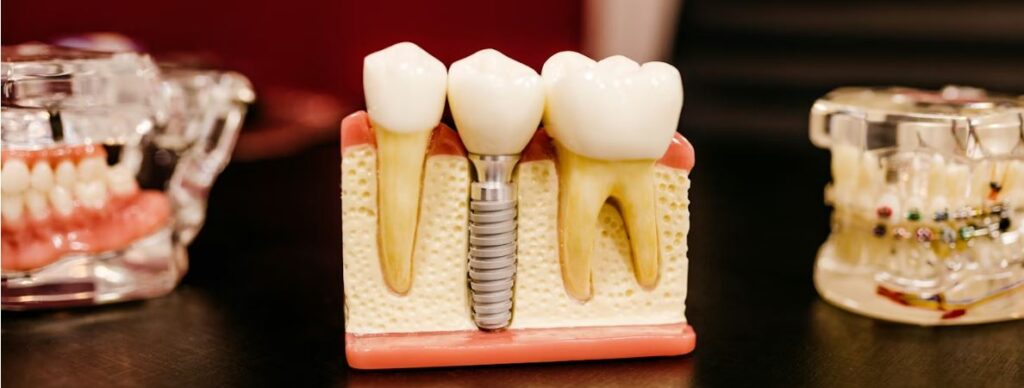 Supplemental Dental, Vision, and Hearing Coverage